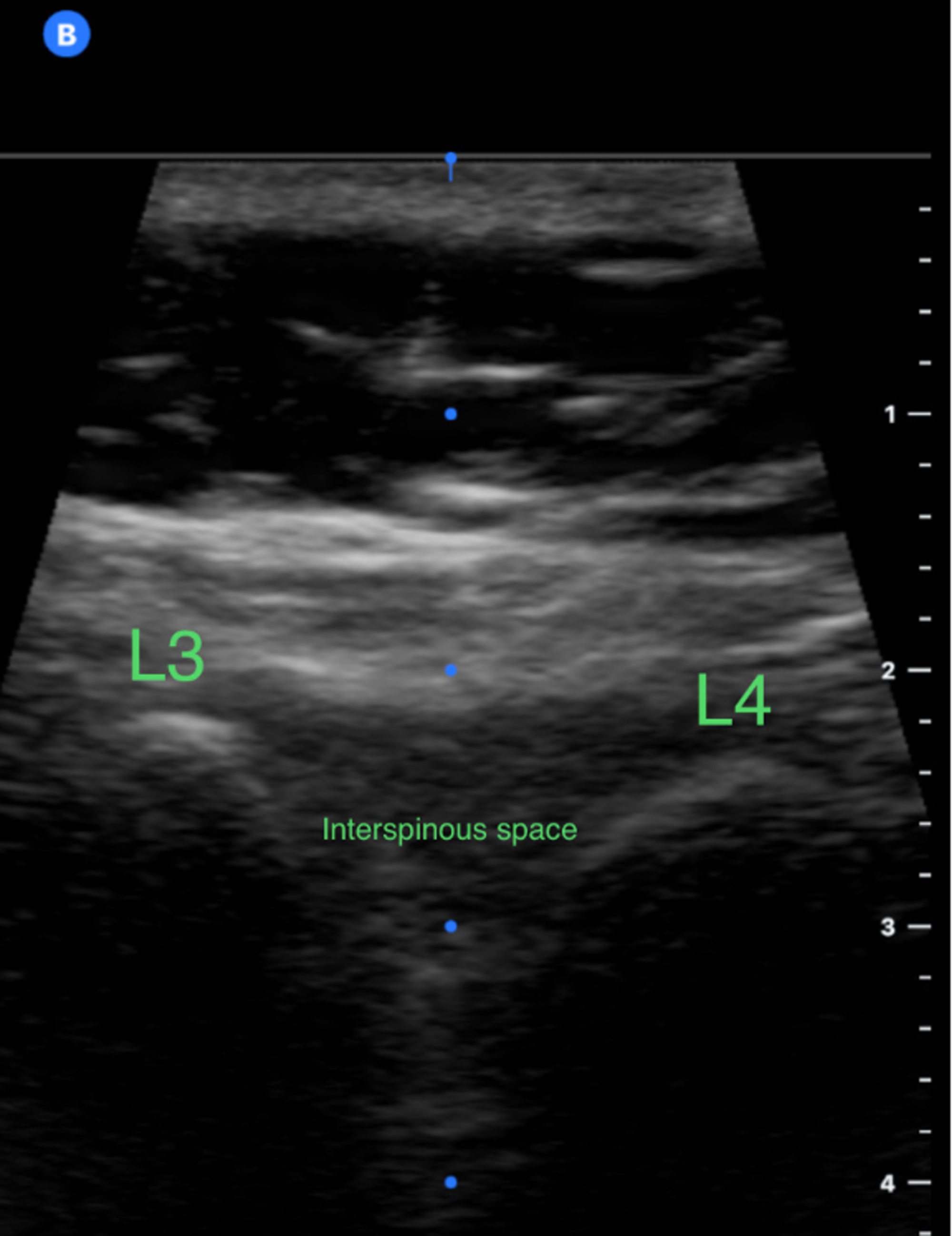 Cureus Feel It, See It, Get It Is Internal Medicine Residents’ Use