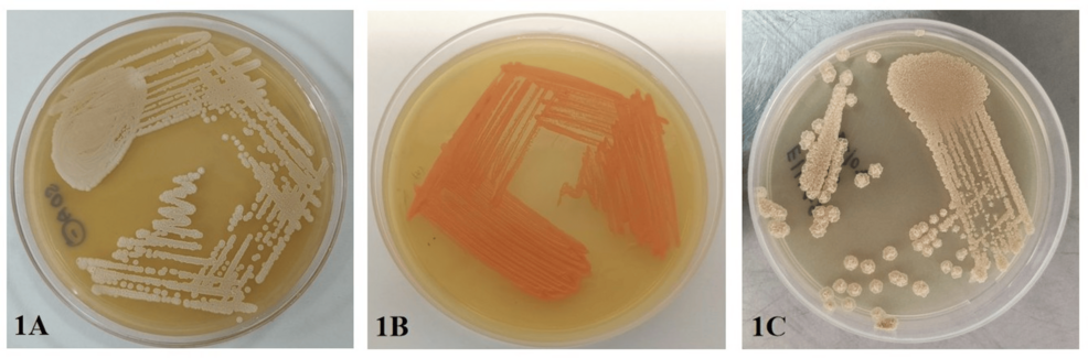 Fungal infections in peritoneal dialysis patients chart