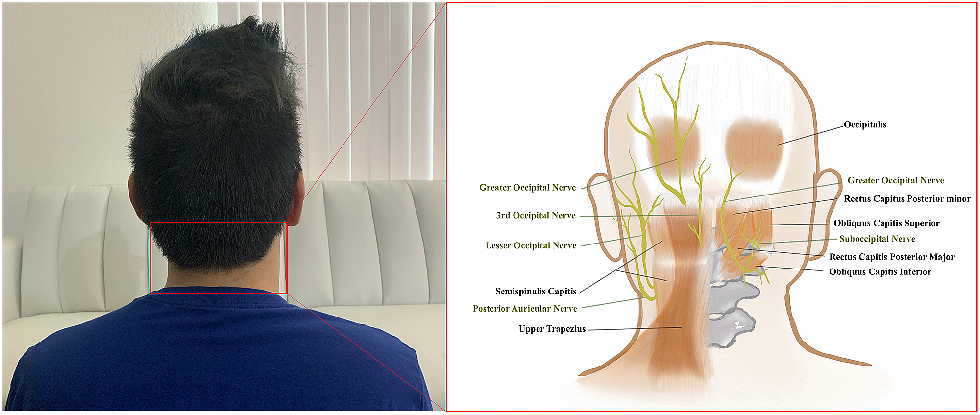 Cureus | Osteopathic Manipulative Treatment in Tension Headaches