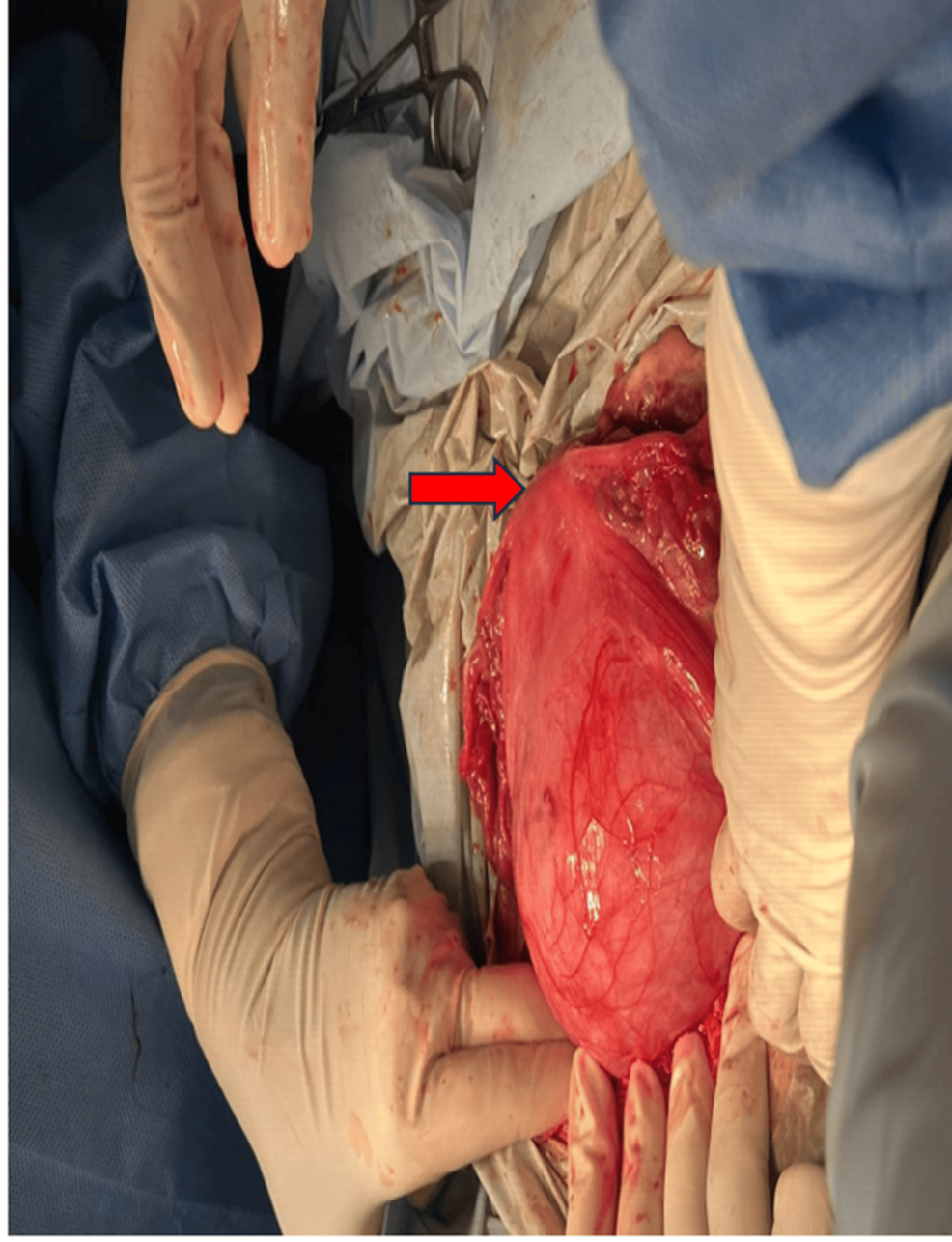 semaglutide injections near wadsworth Semaglutide in Nashville