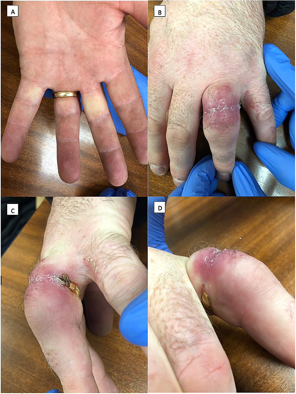 Widespread rash in toddler | MDedge Family Medicine