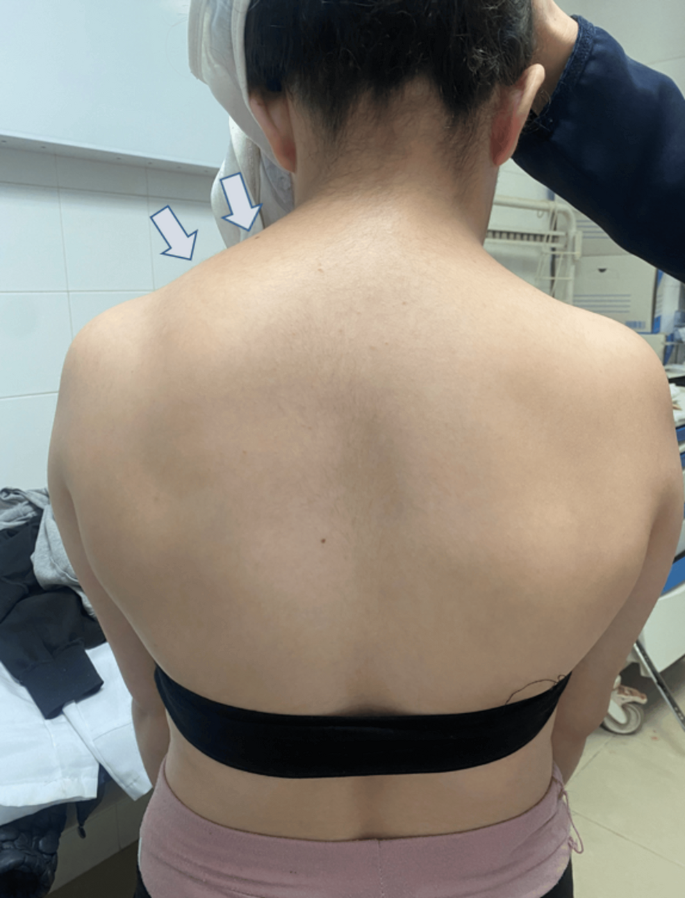 Klippel feil syndrome | PPTX, image size:986x1292