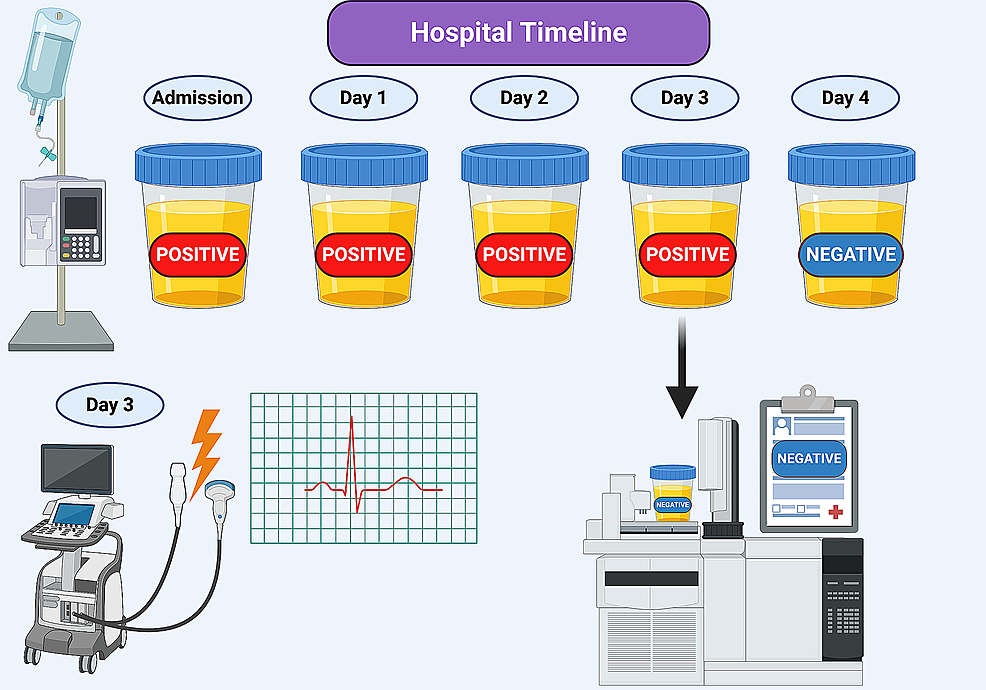 Cureus A Case of Esmolol Induced False Positive Amphetamine