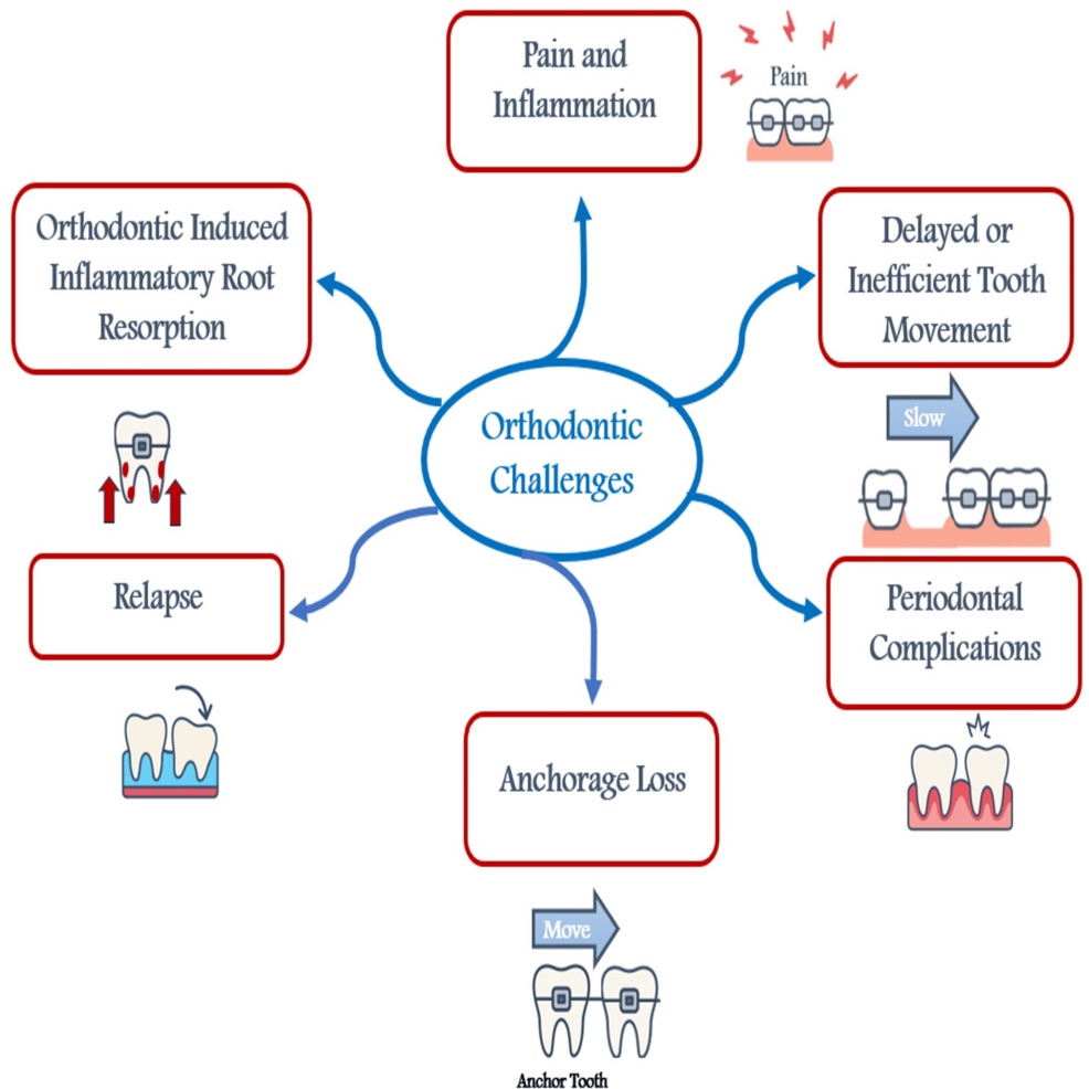 Statins in Orthodontics: Pharmacological Modulation of Relapse and Tooth  Movement | Cureus