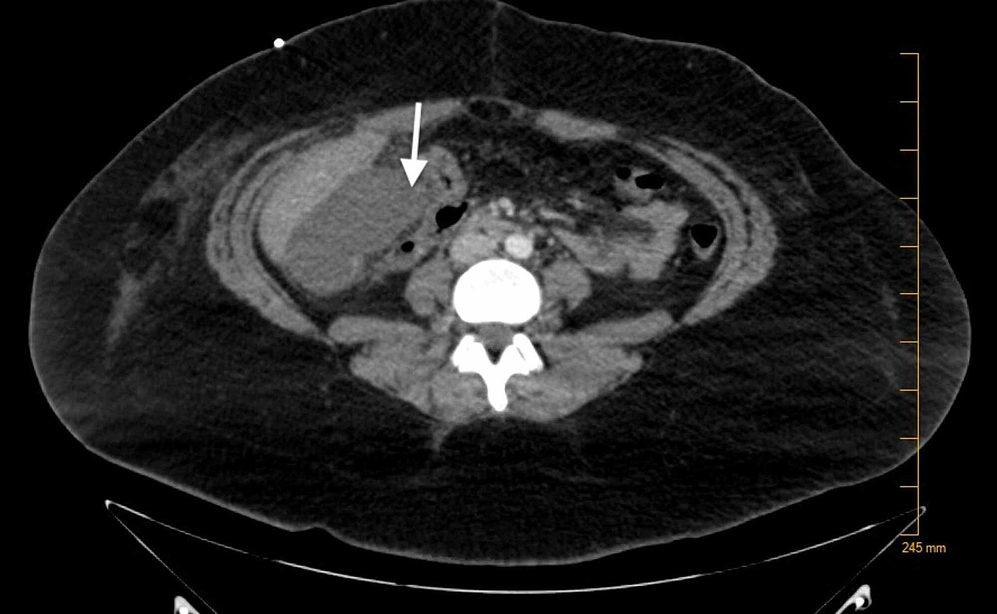 Cureus Primary Psychiatric Disorder Masking the Diagnosis of Lupus