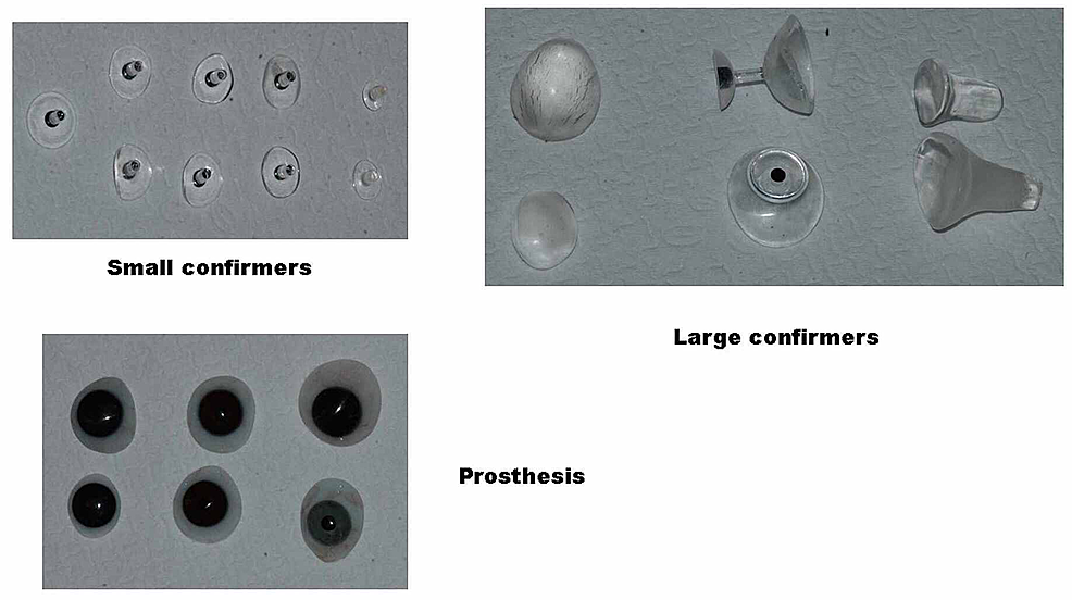 Small,-medium,-and-large-eye-conformers-and-prosthetics-that-were-used-for-orbital-enlargement-in-anophthlamic-and-severe-microphthalmic-sockets