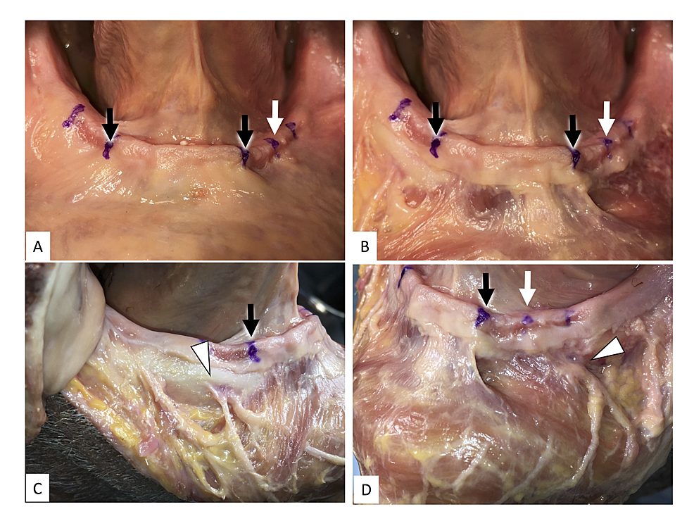 Cureus | Clinical Anatomy of the Frenulum of the Oral Vestibule
