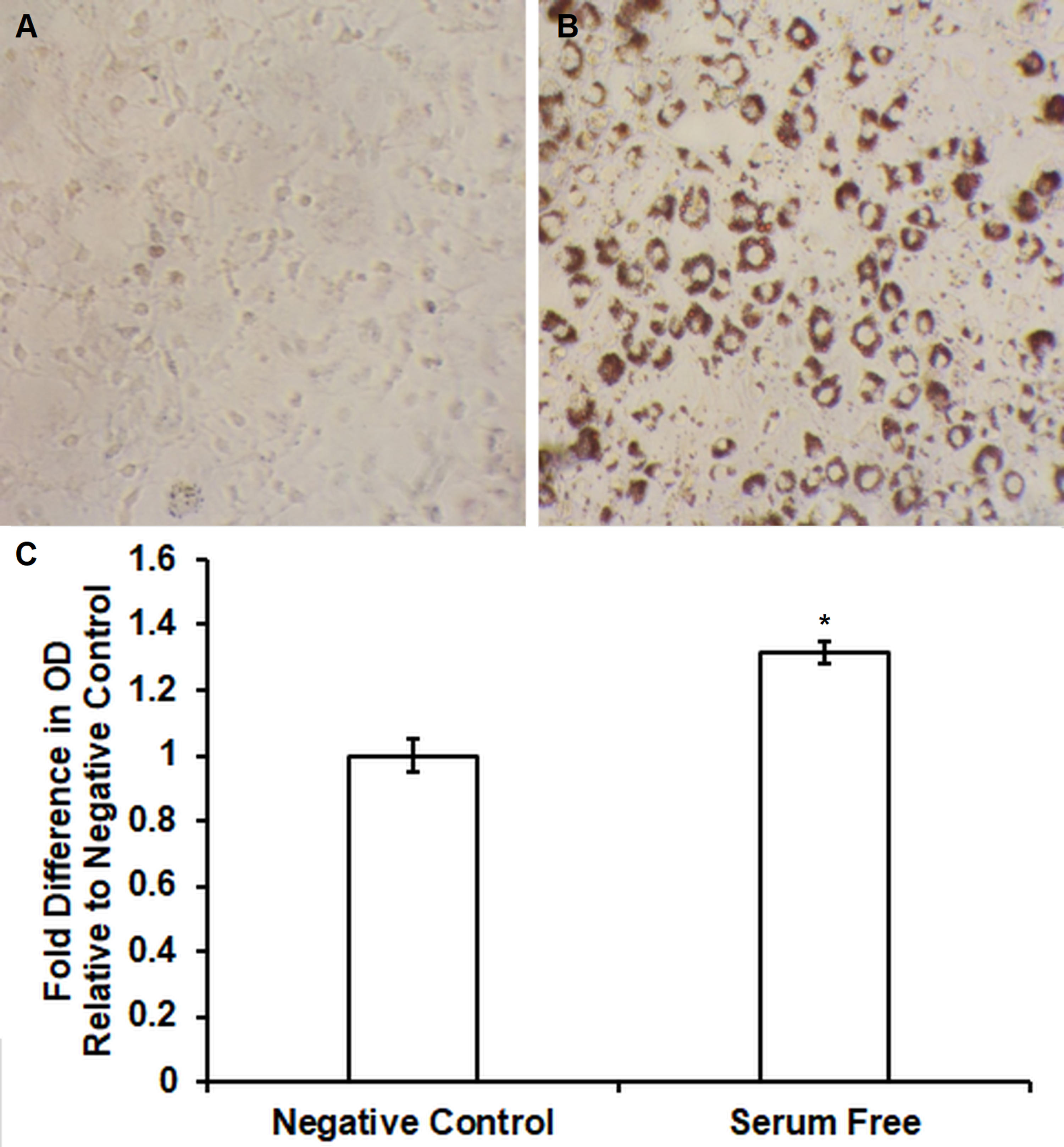 Cureus Induction Of Adipogenic Genes By Novel Serum Free Conditions From Pre Adipocyte 3t3 L1 And St2 Cells
