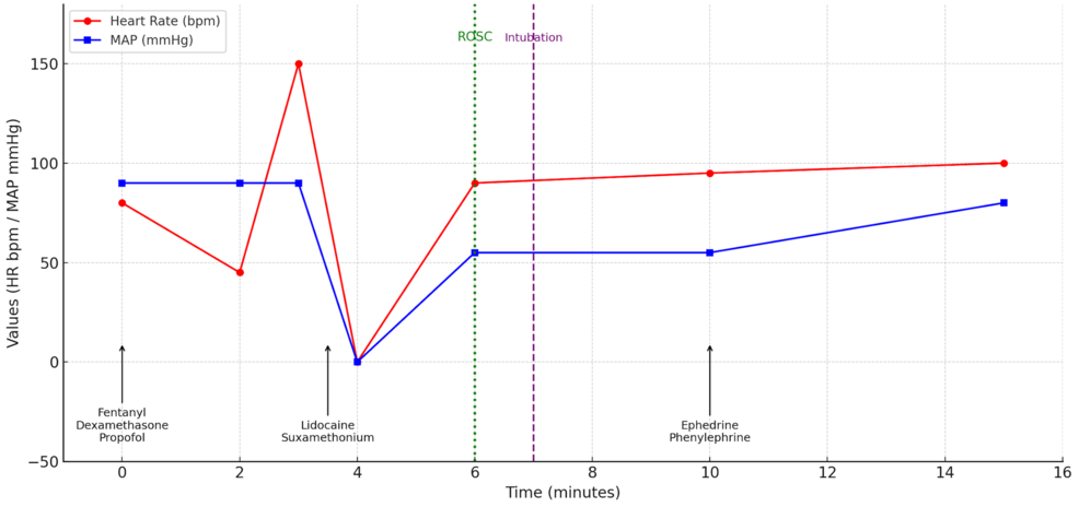 When the Heart Breaks in the Operating Room (OR): Intraoperative Arrest as a First Sign of Takotsubo Cardiomyopathy