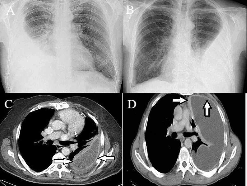 Cureus | Early Functional Results of Surgery for Organizing Phase of