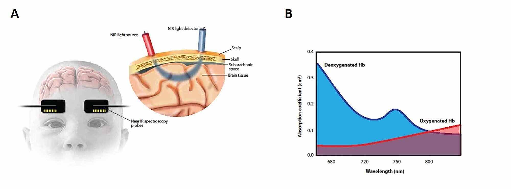 the visitor returns ventricular penetration