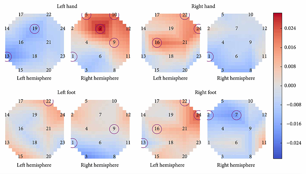 Average-difference-in-activation-between-motor-execution-and-motor-imagery.