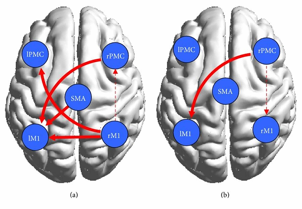 Results-of-the-motor-network-causal-interactions-in-the-controls-versus-the-stroke-patients-during-ME-and-MI.