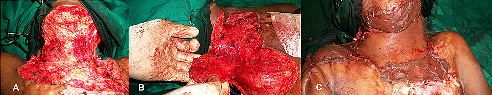 Intraoperative-pictures