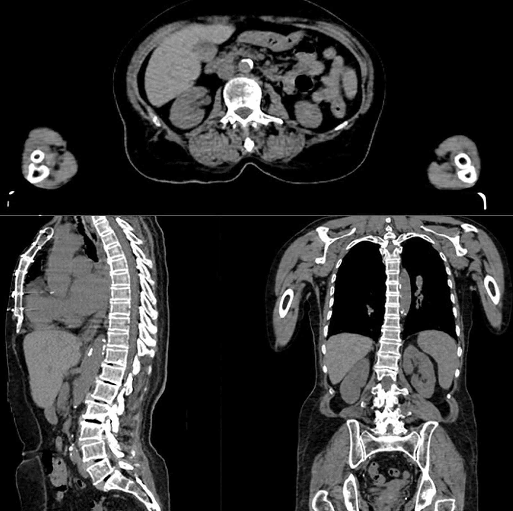 Investigation of the Effects of ThreeDimensional Modeling Techniques