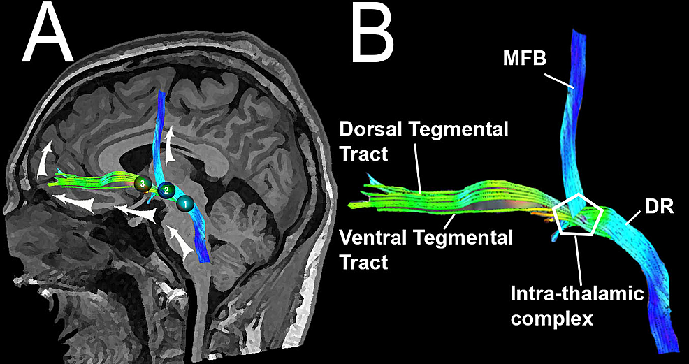 reticular activating system