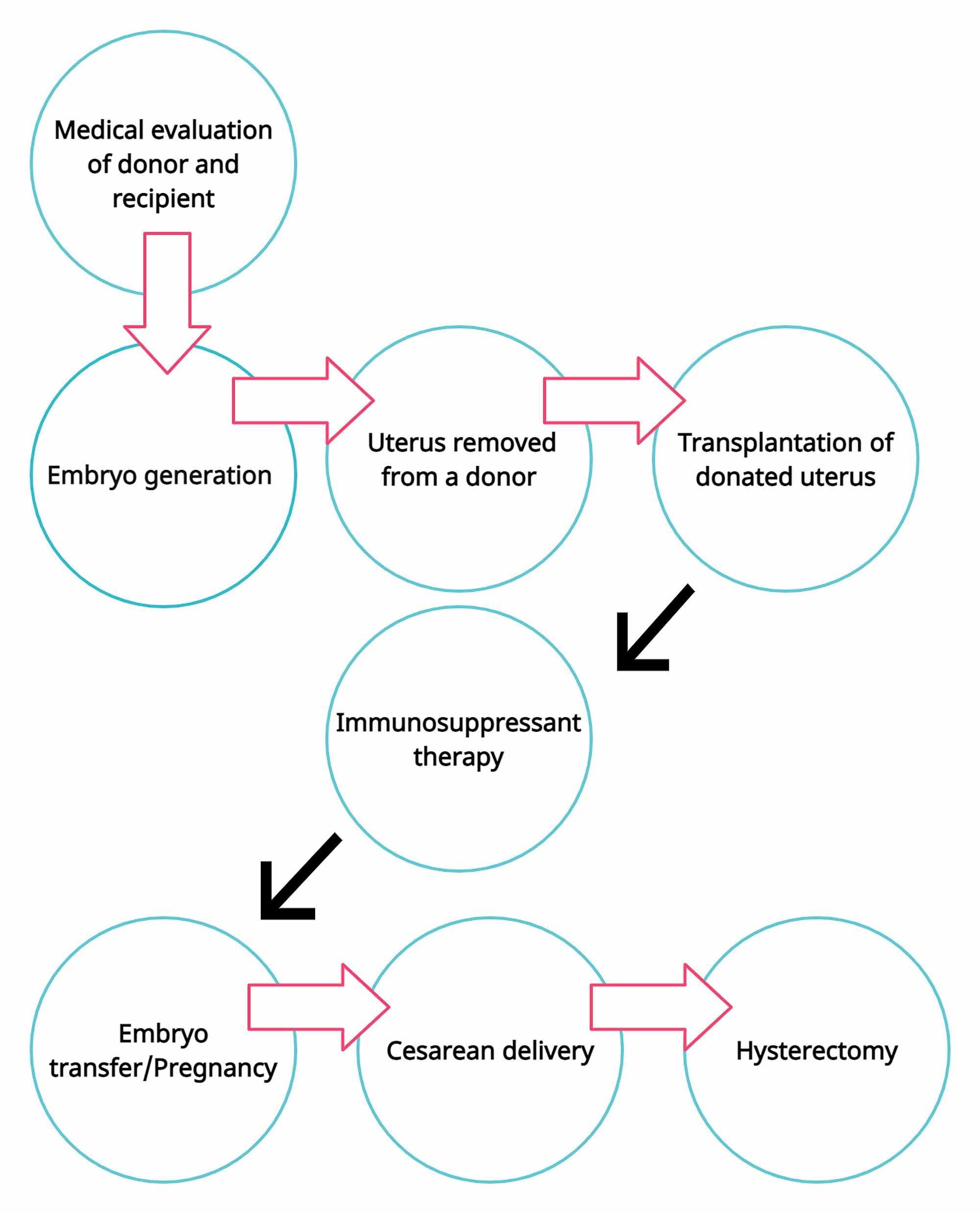 Cureus | A New Approach For Treatment Of Woman With Absolute Uterine ...