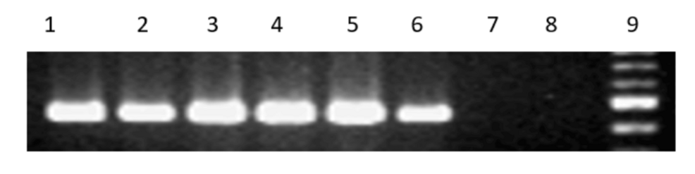 Helicobacter pylori'nin ureB geninin PCR-amplifikasyonu
