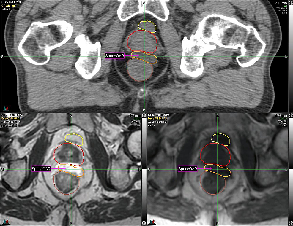 CT-and-MRI:-Axial-View-