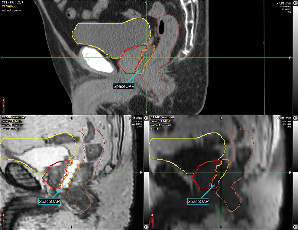 CT-and-MRI:-Sagittal-View-