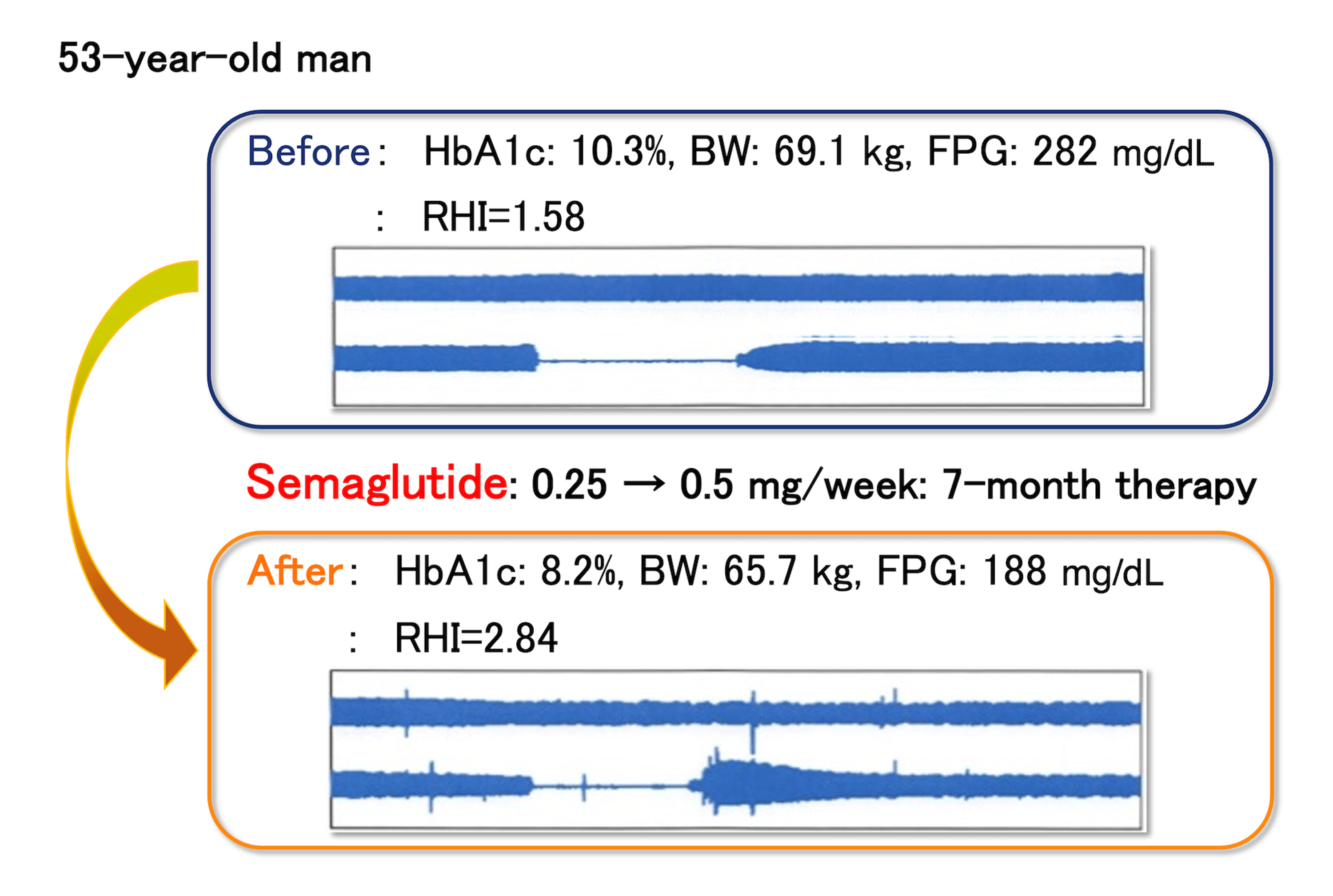 how many mg is 75 units of semaglutide Compounded Semaglutide Dosage Chart: Your Guide to Safe Weight Loss how many mg is 75 units of semaglutide Compounded Semaglutide Dosage Chart: Your Guide to Safe Weight Loss