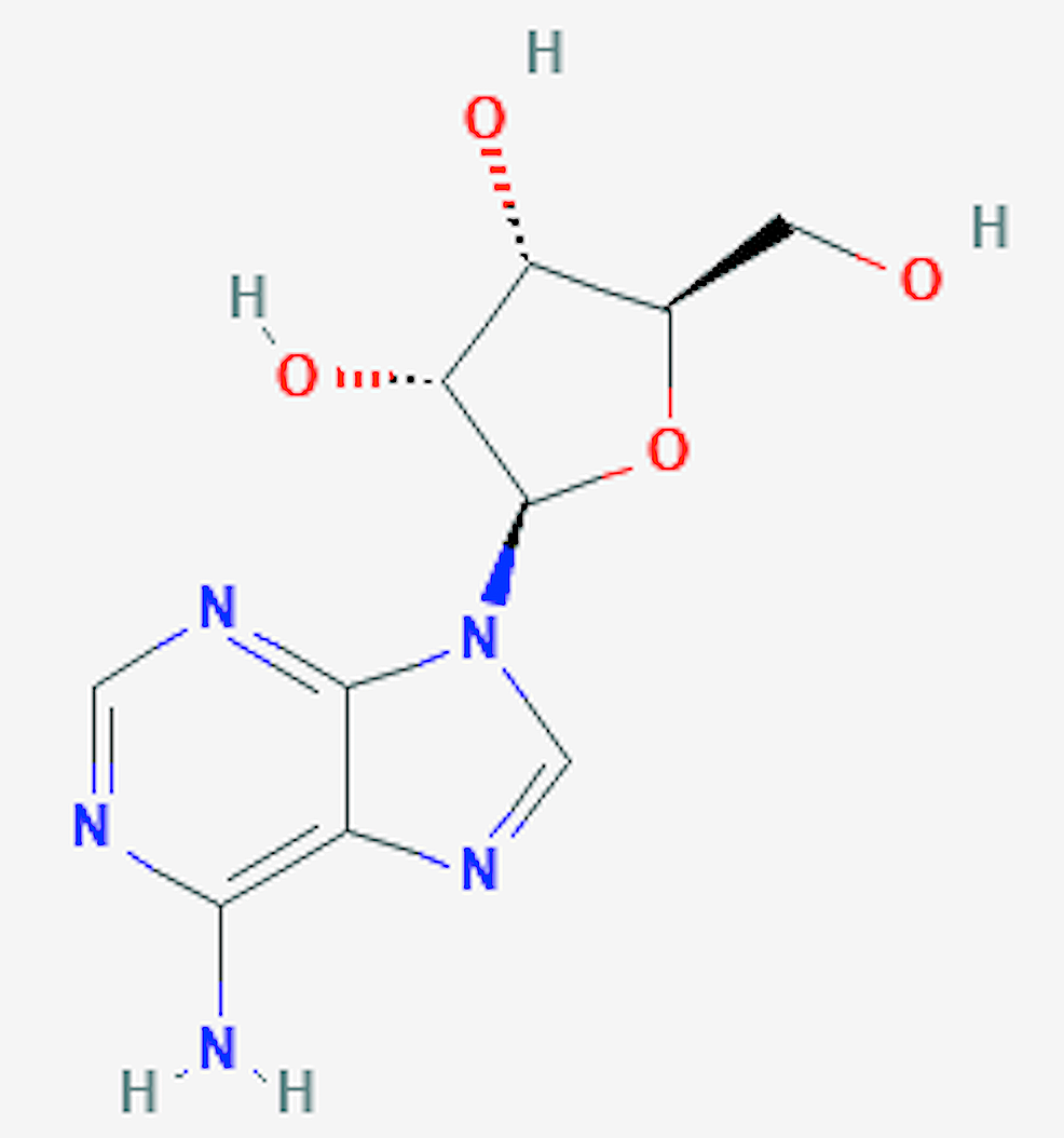 Cureus | Regadenoson Stress Testing: A Comprehensive Review With a ...