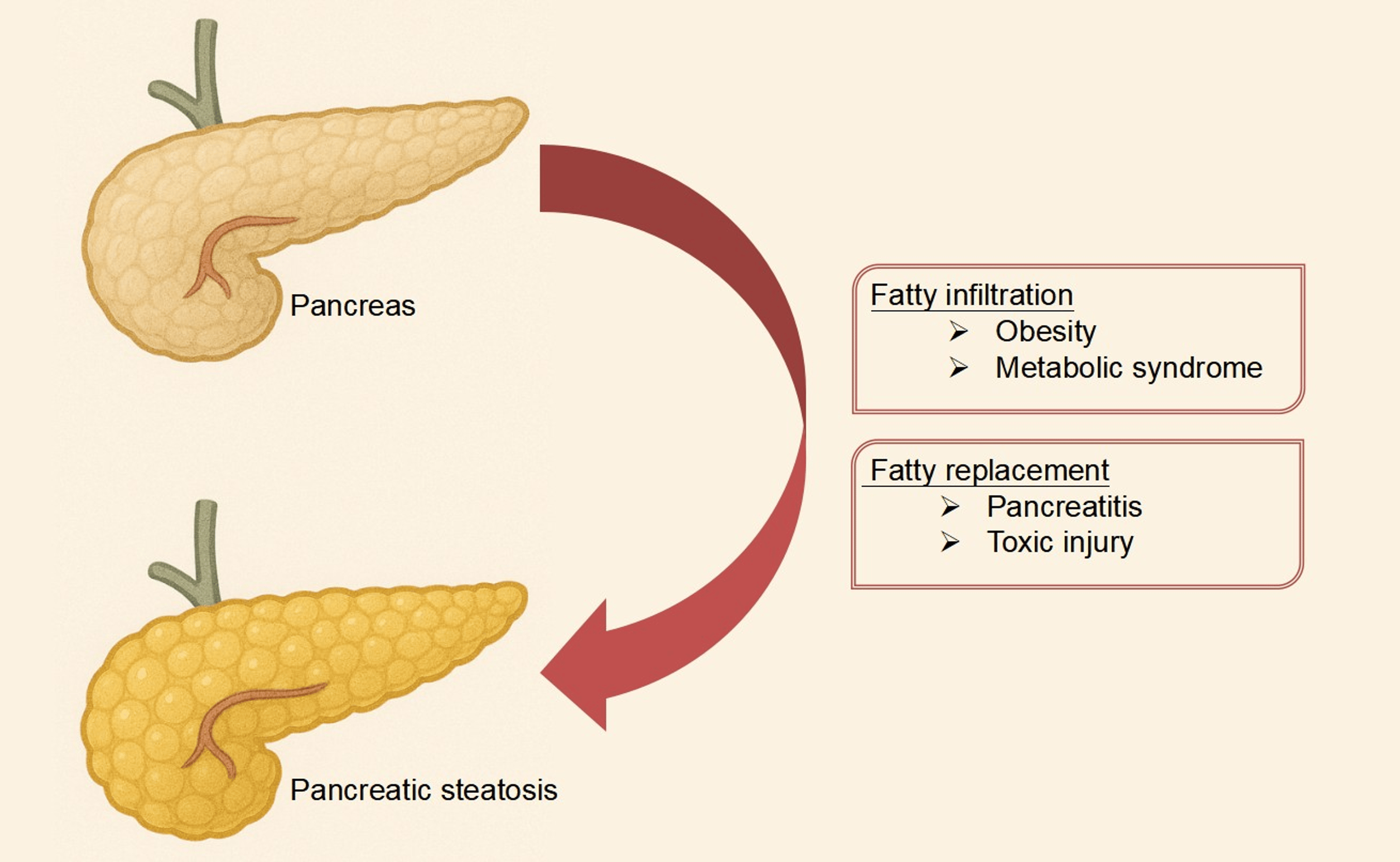 The Fat-Pancreas Axis: A Narrative Review Unraveling the Role of Obesity in Pancreatic Diseases