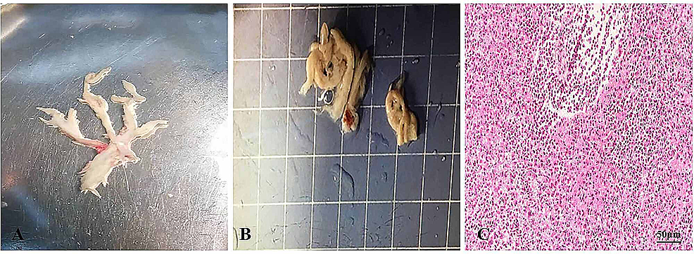 Findings-of-Bronchoscopy-and-Histopathological-Examinations