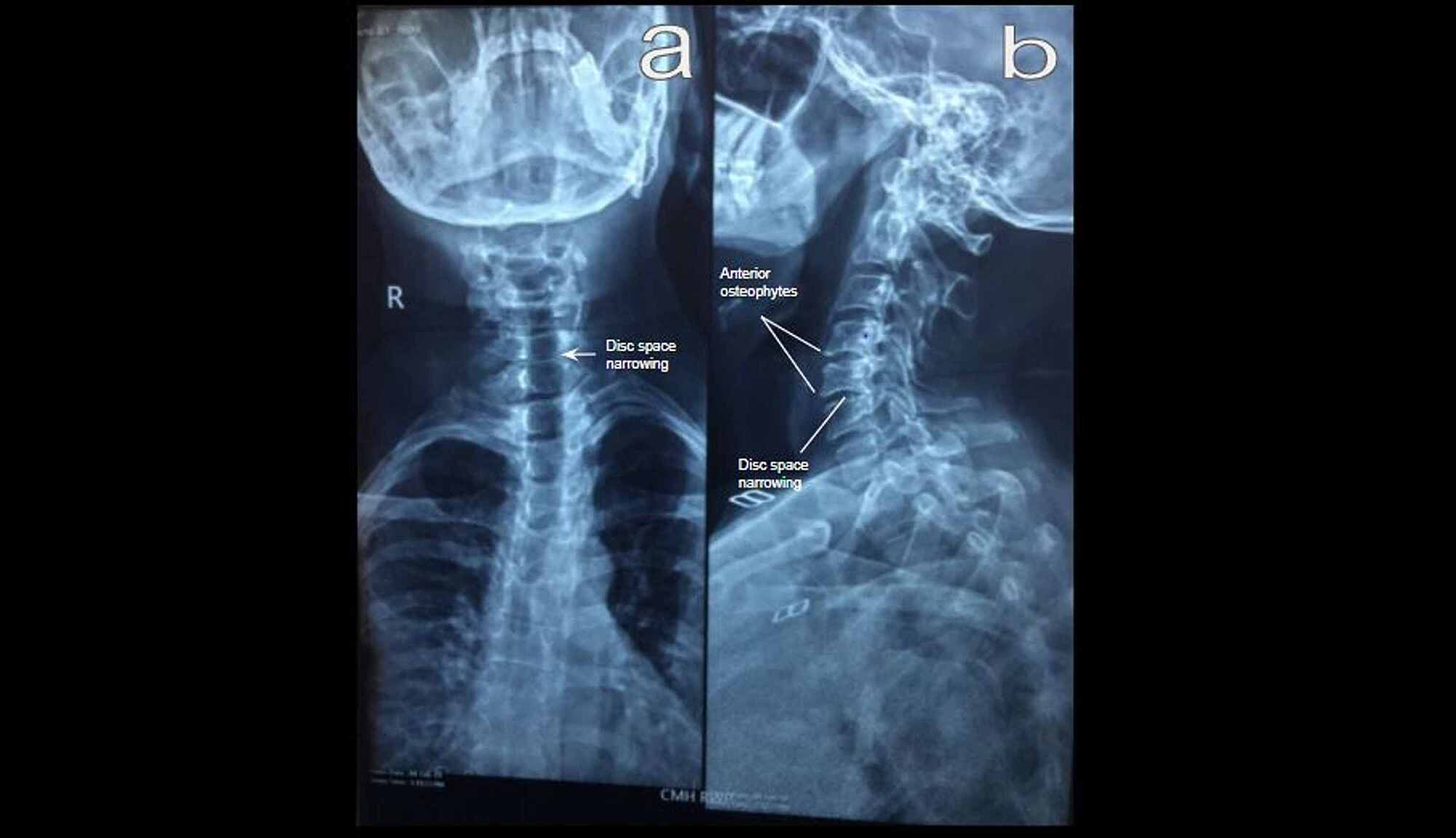 x ray cervical spine cost scottsdale az