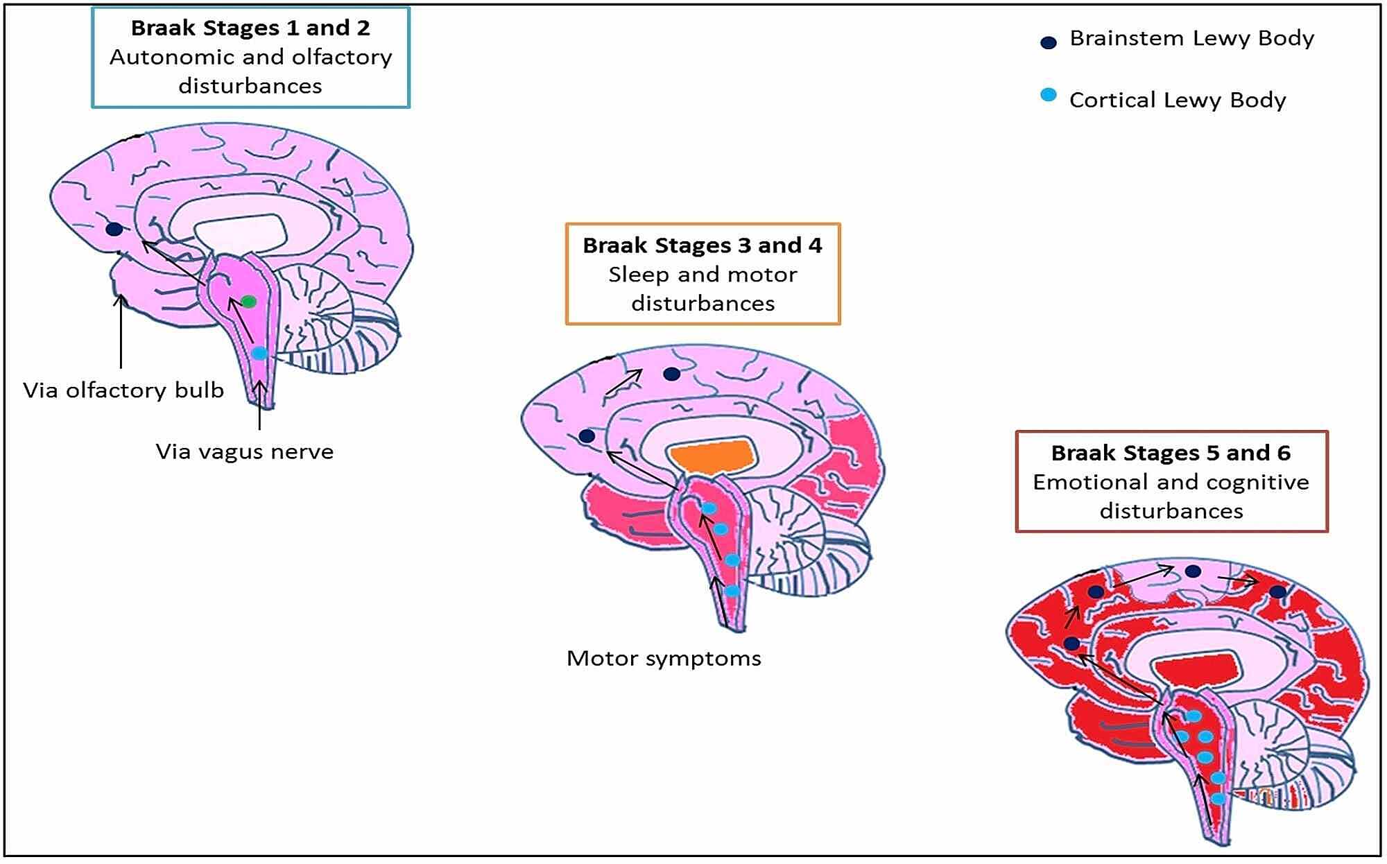 Cureus | Spectrum Of Non-Motor Symptoms In Parkinson's Disease