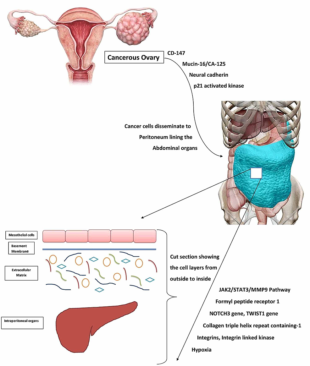 Cureus | Extracellular Matrix: A Treasure Trove in Ovarian Cancer ...