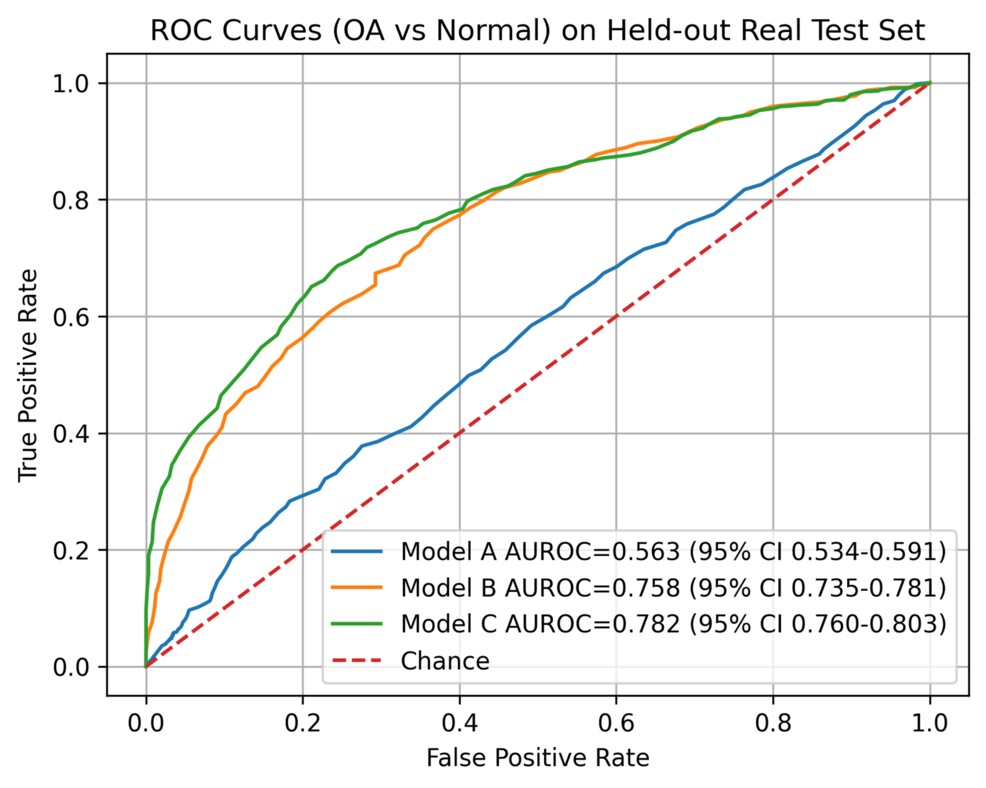 Comparing Real and ChatGPT-Generated Radiographs for Training Deep Learning Models to Diagnose Knee Osteoarthritis