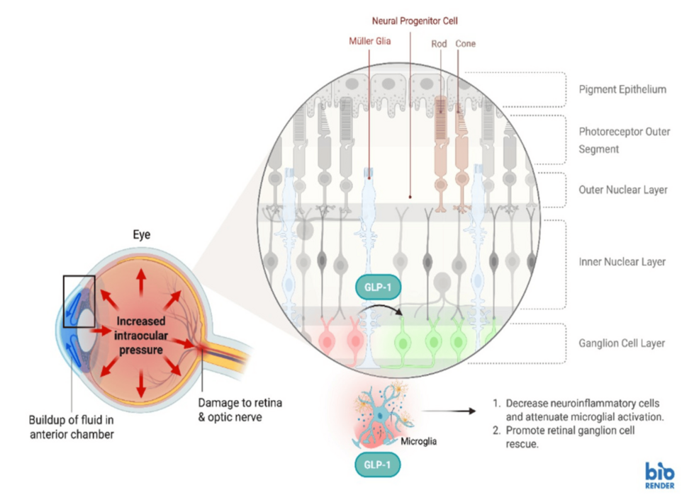 glp 1 blindness reddit The Benefits and Risks of Glucagon-Like Peptide-1 Receptor Agonists on  Ocular Diseases: A Narrative Review