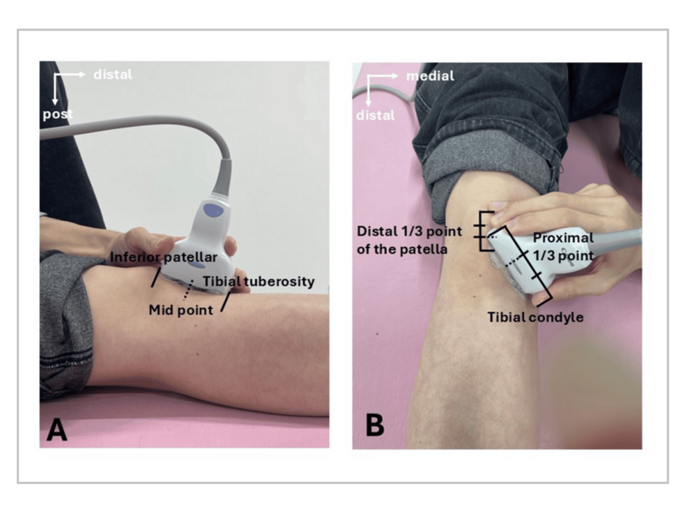 Regional Differences in Infrapatellar Fat Pad Stiffness With Changes in Knee Flexion Angle: A Quantitative Analysis Using Shear Wave Elastography