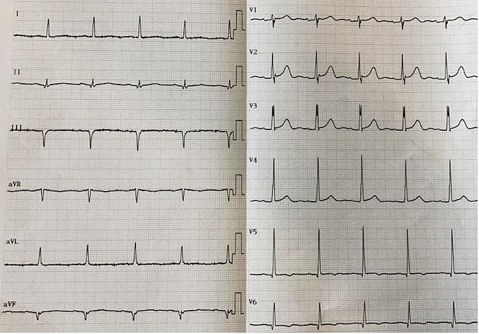 Cureus  Left Ventricular Global Longitudinal Strain in Patients