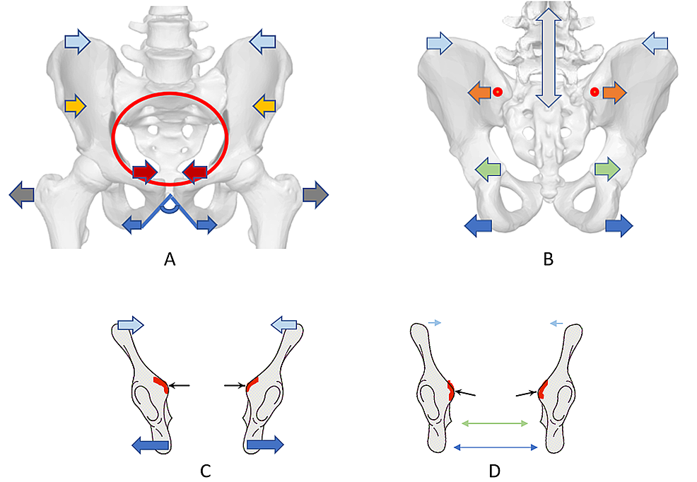 Pelvic-diameters-and-inlet-edge-modification-to-the-squat-positions