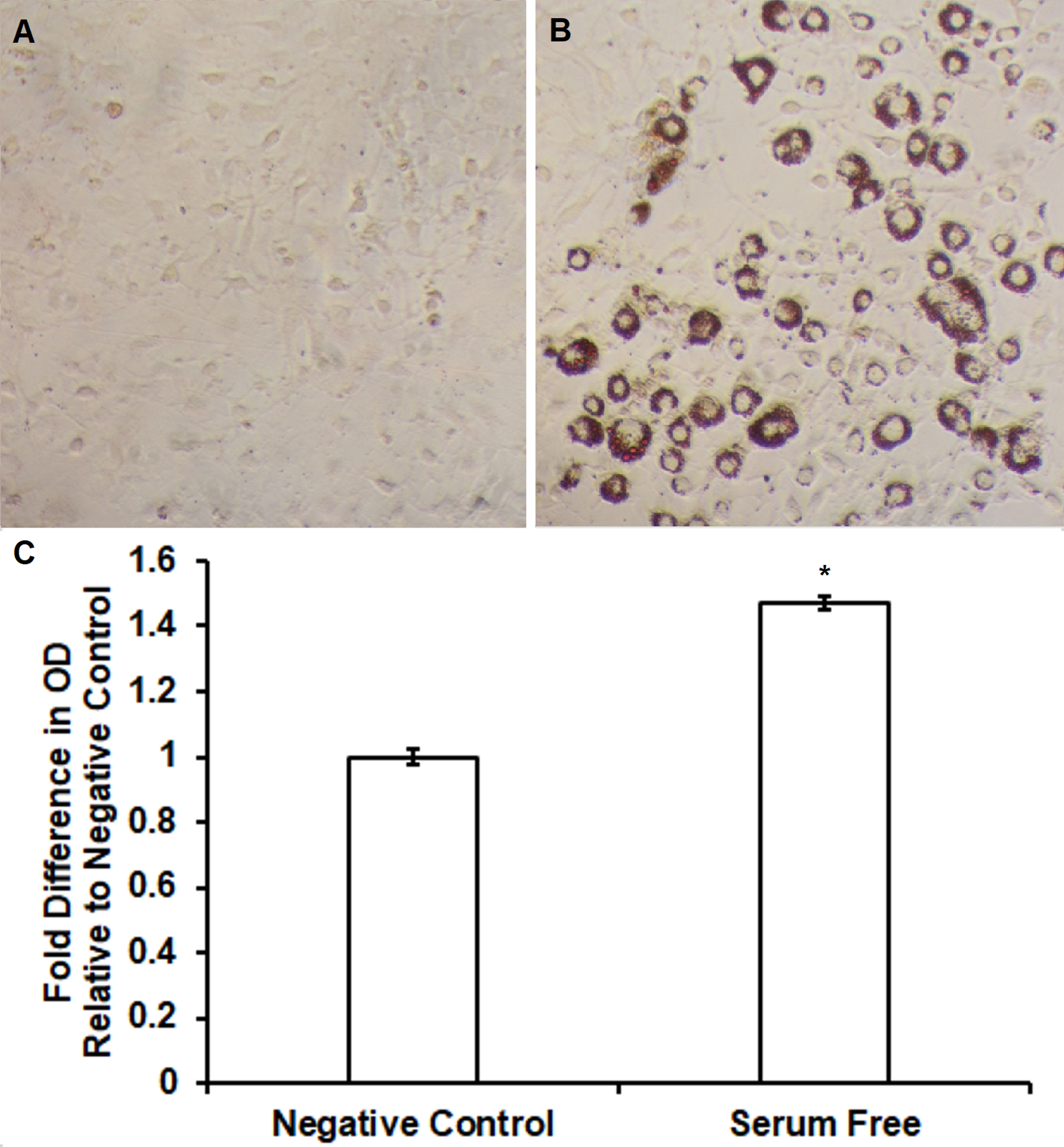 Cureus Induction Of Adipogenic Genes By Novel Serum Free Conditions From Pre Adipocyte 3t3 L1 And St2 Cells