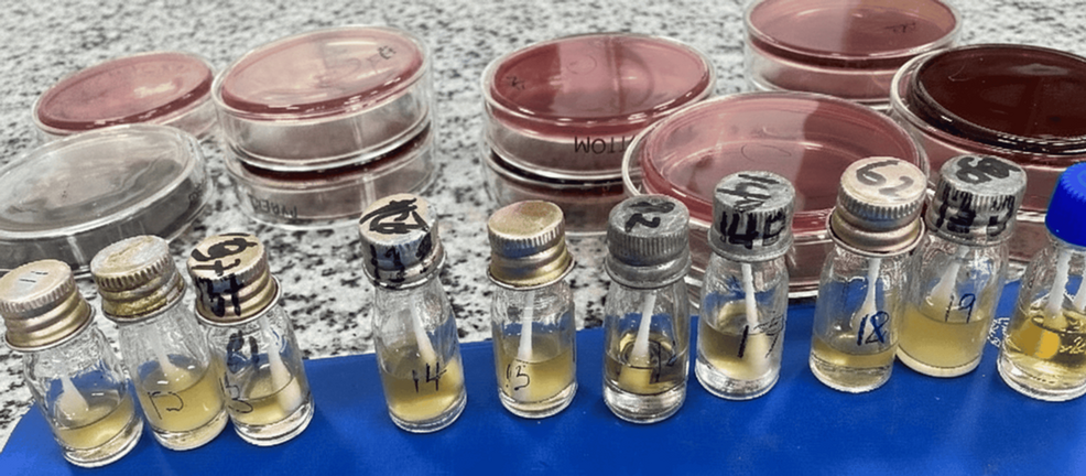 Antibiotic Resistance of Environmental Bacteria in Uganda ICU - News Directory 3