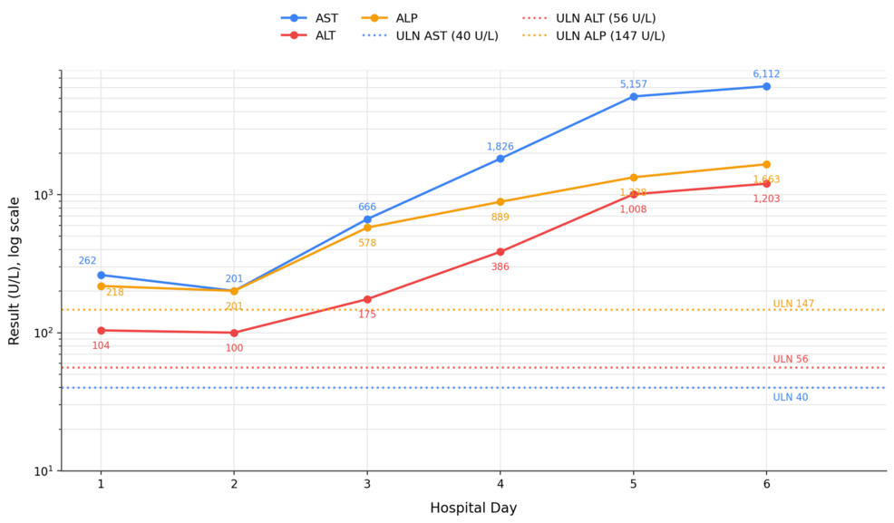 Statin-Induced Fulminant Hepatitis: A Case of Septic Shock and Multiorgan Failure - News Directory 3
