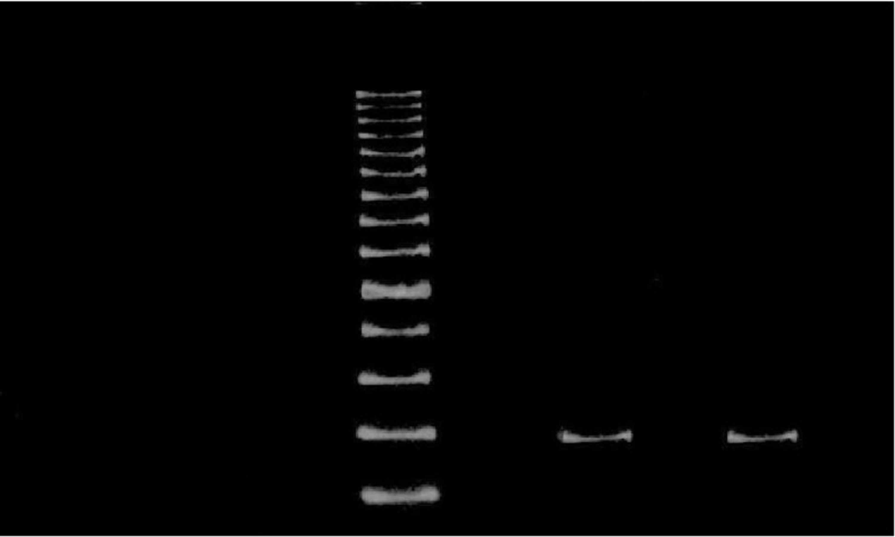 Cureus Molecular Identification Of Human Papillomavirus Dna In Thyroid Neoplasms Association Or Serendipity