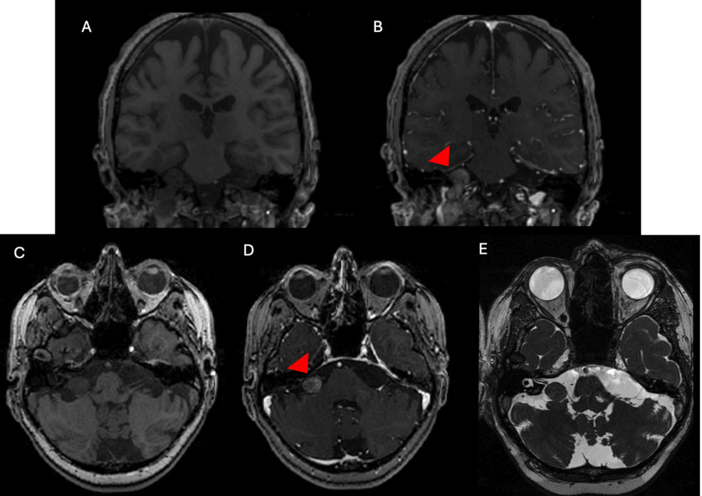 glutathione side effects reddit Cuproptosis-Inducing Functional Nanocomposites for Enhanced and Synergistic  Cancer Radiotherapy main image 0