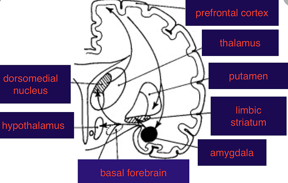 Cureus | Hypnic Headache Responds To Topiramate: A Case Report And A ...