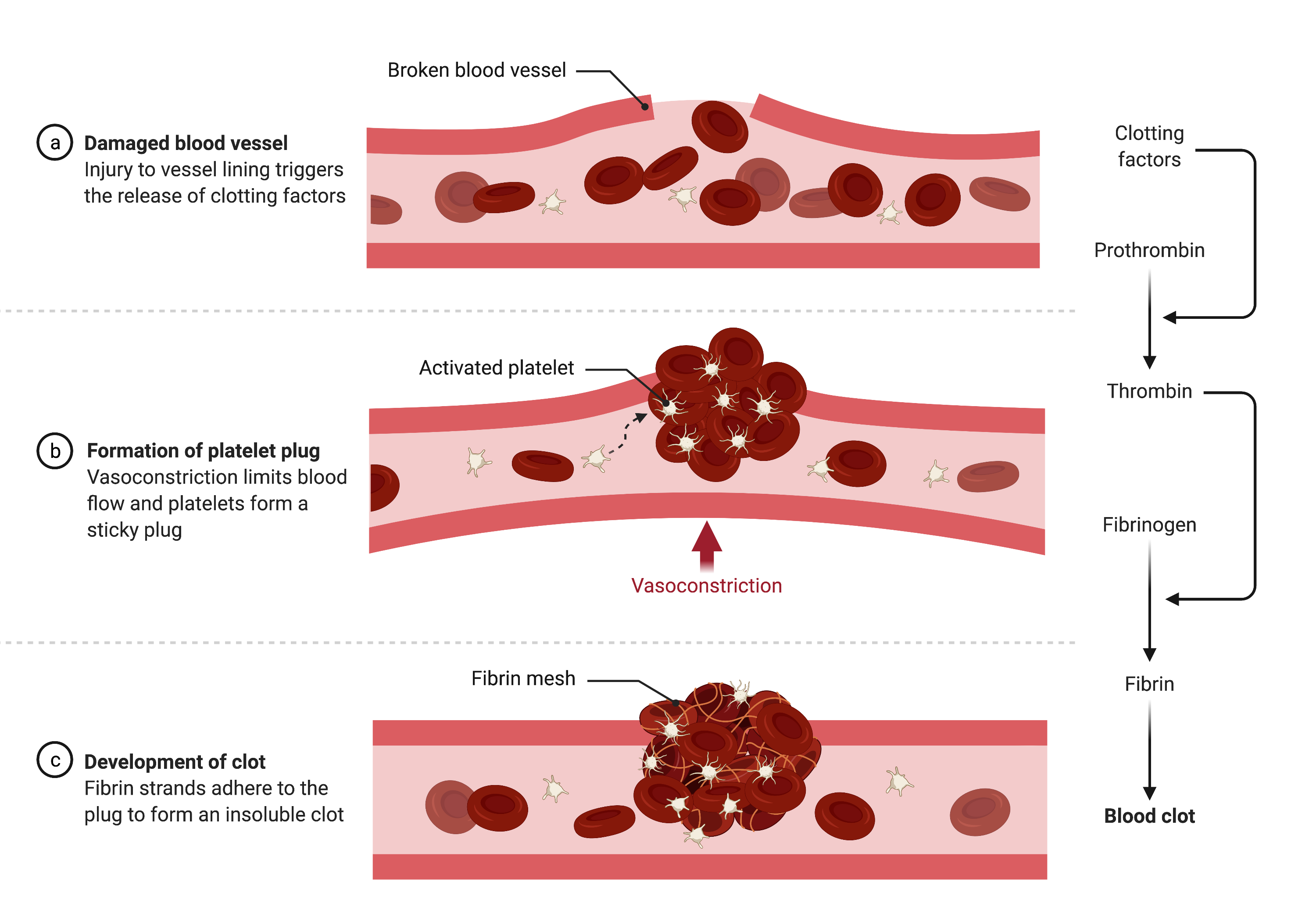 Cureus Bilateral Pulmonary Emboli on Dabigatran