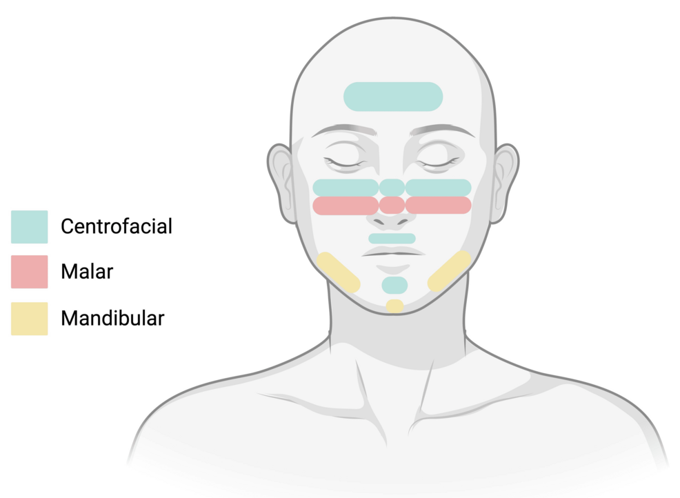 can you use melanotan 2 without sunlight reddit A Comprehensive Strategy for Safe, Intelligent Exposure Melanotan II  Complete Guide