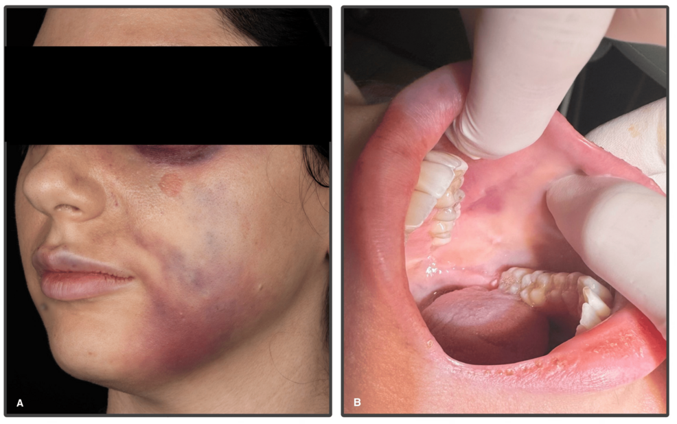 klower lip twitches reddit Twitching When Nervous fyp aymskeyrd | lower lip