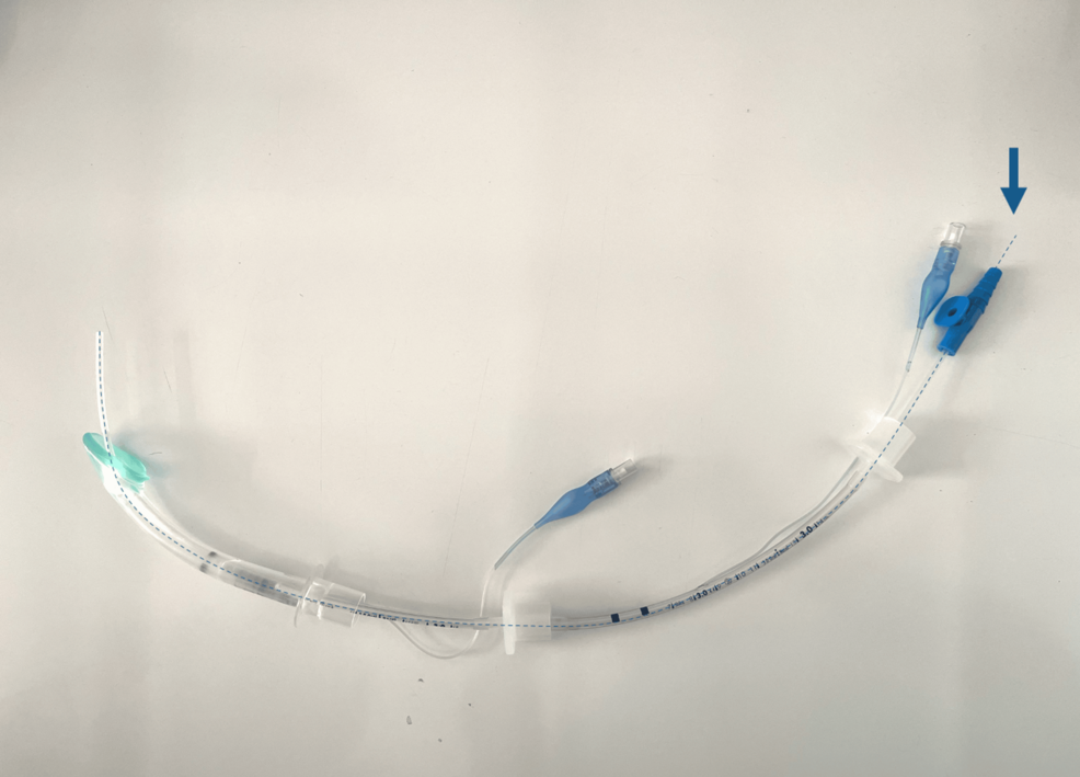 Fiberoptic-Guided-Intubation-Through-a-Laryngeal-Mask-Airway