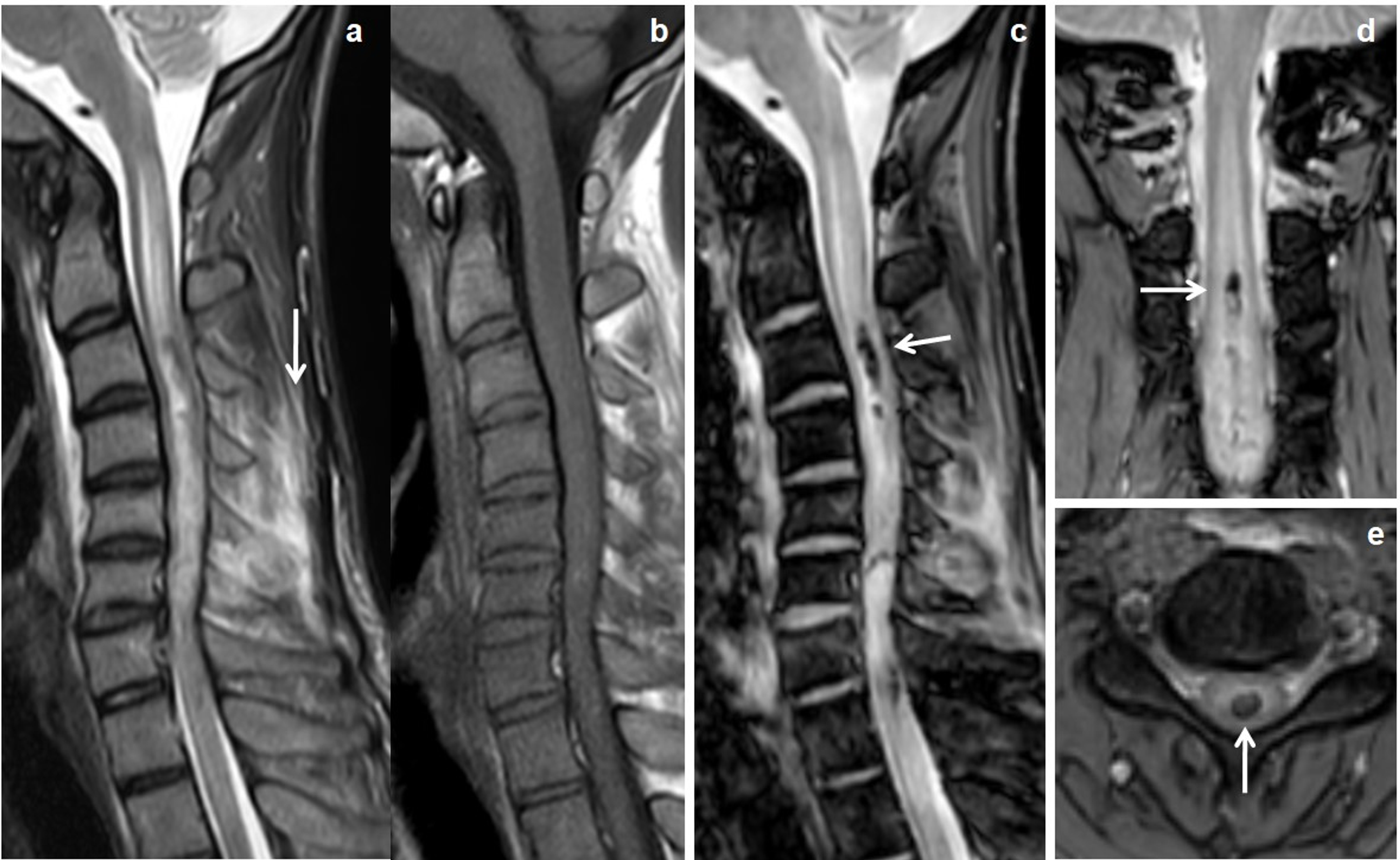 Cureus | Added Value of Three-Plane Multiecho Fast Field Echo MRI ...