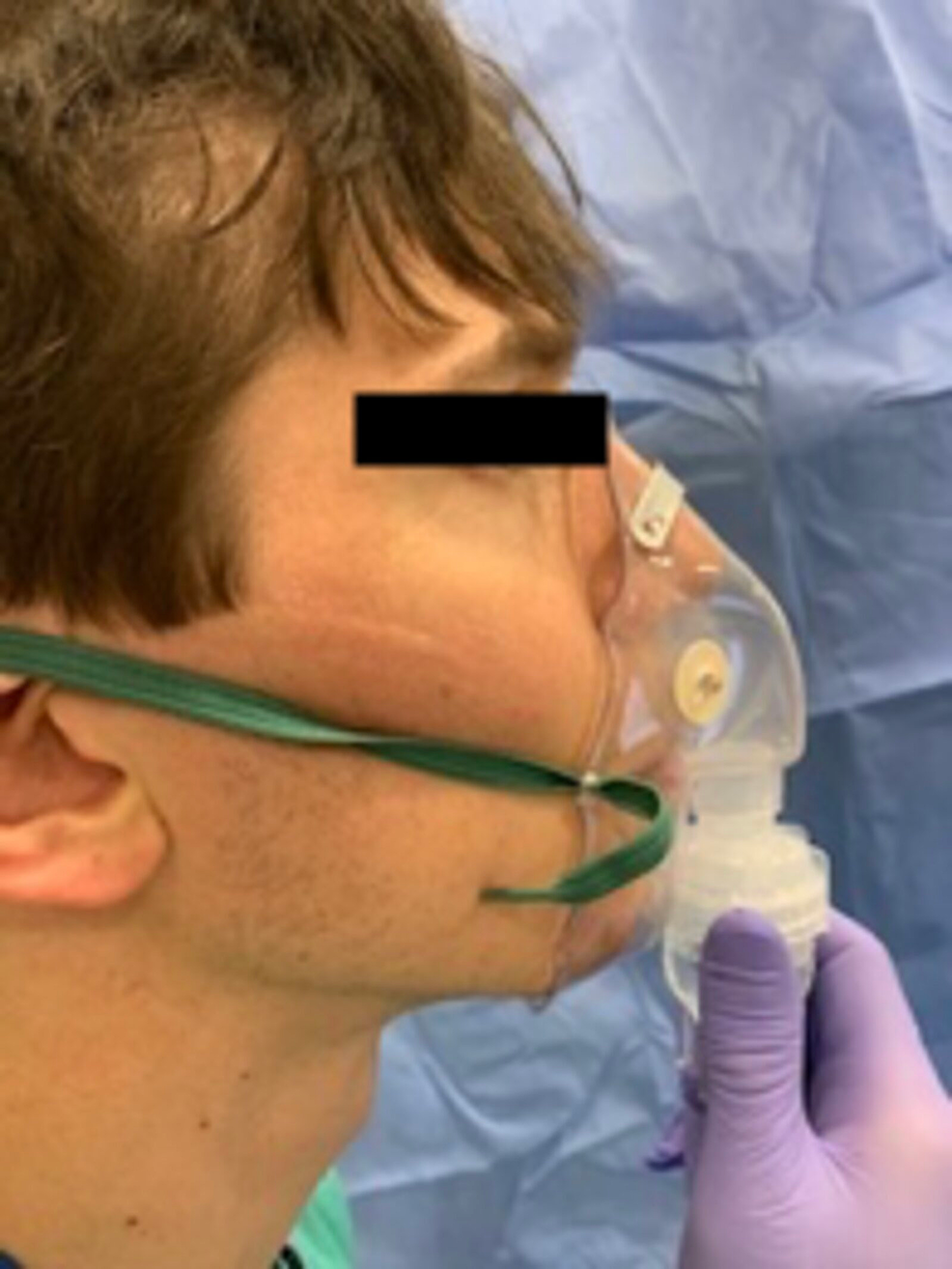 Cureus Airway Anesthesia for Awake Tracheal Intubation A Review of