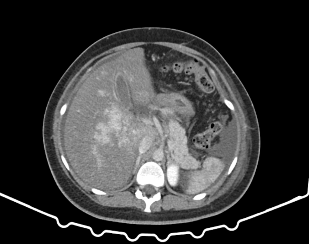 CT-scan