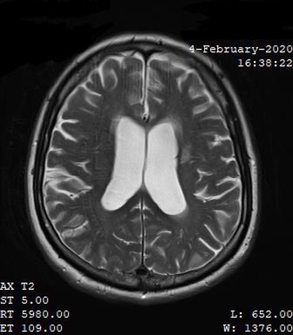Patient-MRI-performed-on-February-4,-2020